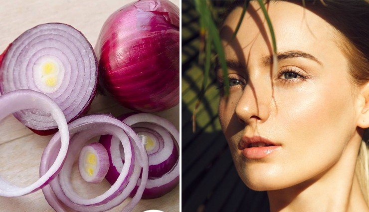 How to Use Onion Juice for Glowing Skin and Dark Spot Removal